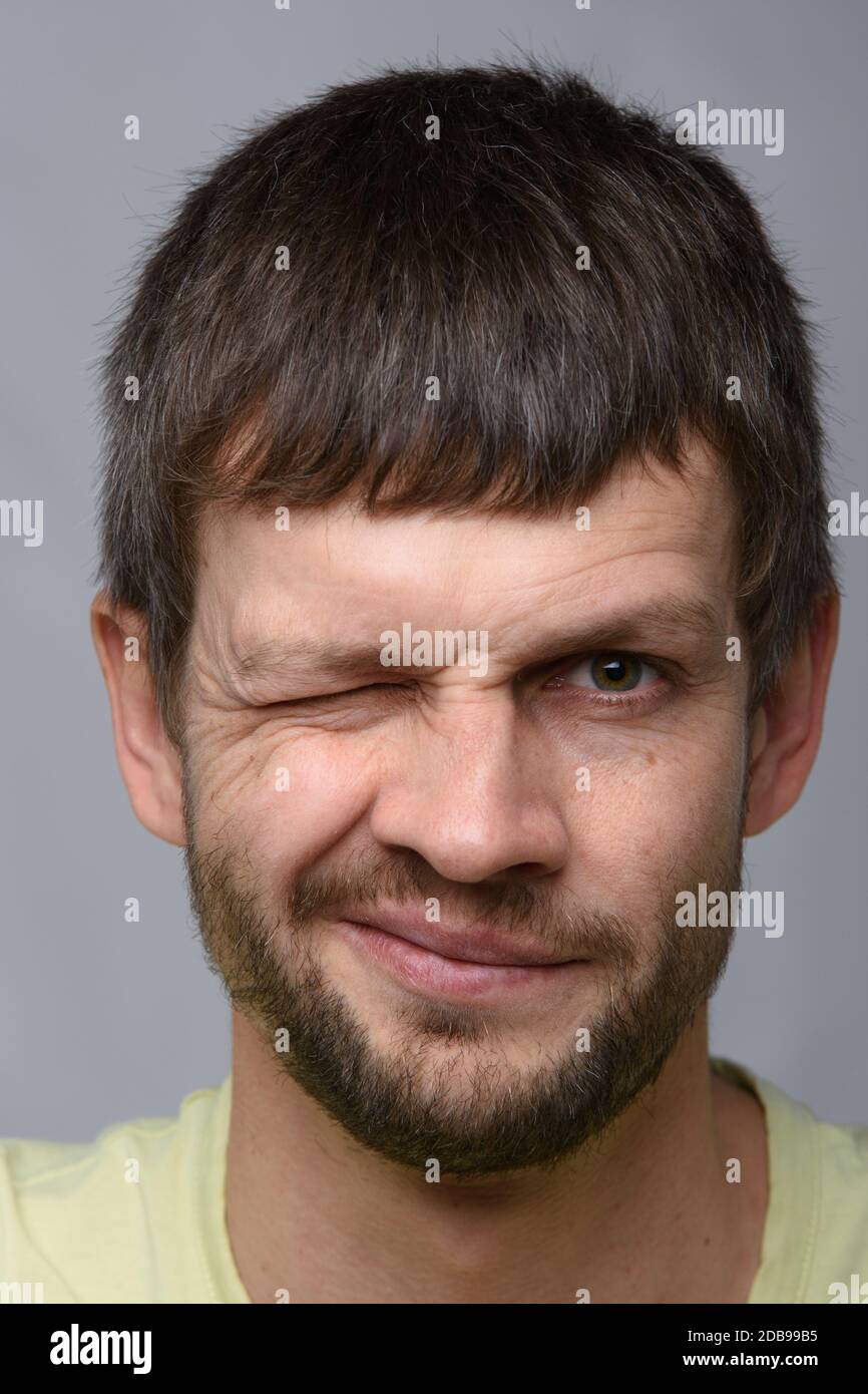 Nahaufnahme eines Mannes, der ein Auge bedeckt, europäisches Aussehen Stockfoto