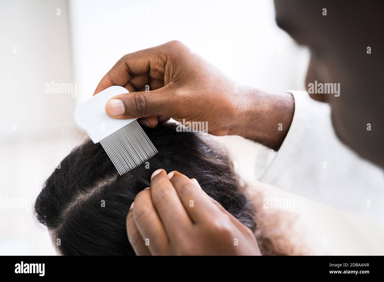 Nahaufnahme der Person Hand mit Läusen Kamm auf der Patientin Haar  Stockfotografie - Alamy