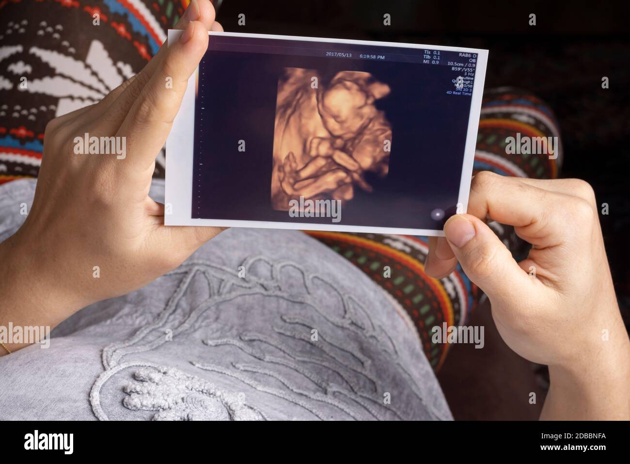 Junge Mutter hält ein ungeborenes Baby Sonographie 4d Bild in den Händen auf dem Sofa ruhend Stockfoto