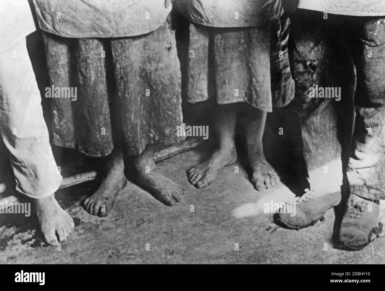 Dieses Bild zeigt die Füße junger Menschen, die in der Nähe von Moskau um Brot betteln, die im Zuge der Hungersnot durch die Zwangskollektivierung der Landwirtschaft verarmt und hungern. Stockfoto