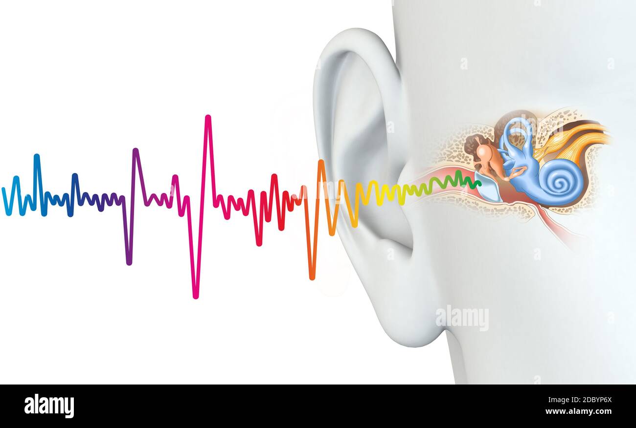 Menschliches Ohr mit Mittelohr, Otitis, Gehörgang, Trommelfell, Gehörgang und Cochlea-Nerv Stockfoto