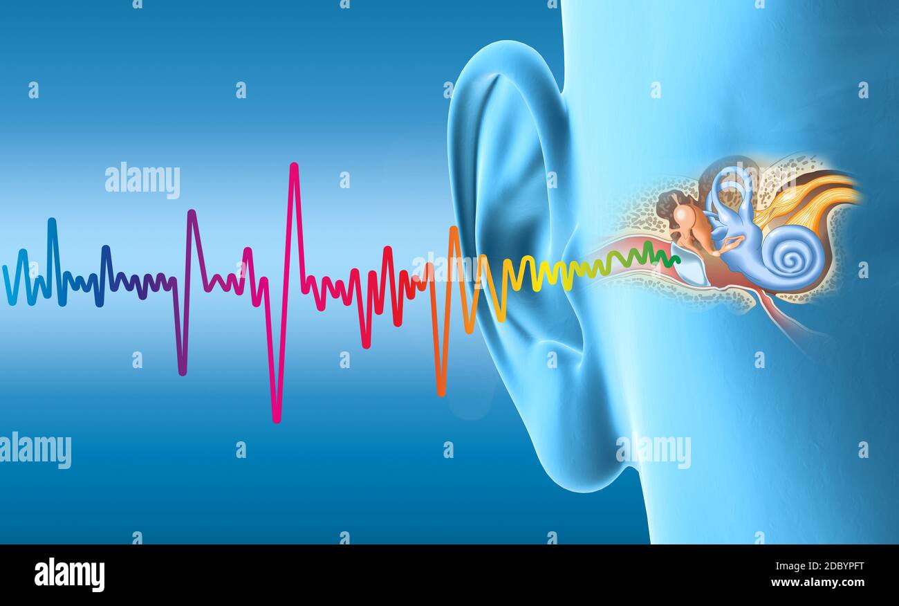 Menschliches Ohr mit Mittelohr, Otitis, Gehörgang, Trommelfell, Gehörgang und Cochlea-Nerv Stockfoto