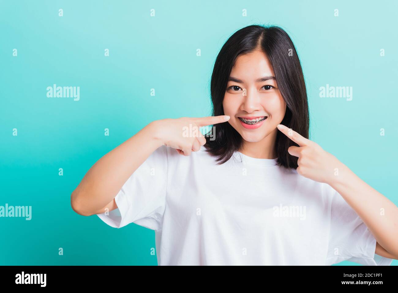 Portrait von Asian teen schöne junge Frau Lächeln haben Zahnspangen auf den Zähnen Lachpunkt Finger ihren Mund, Studio erschossen auf einem blauen Hintergro isoliert Stockfoto