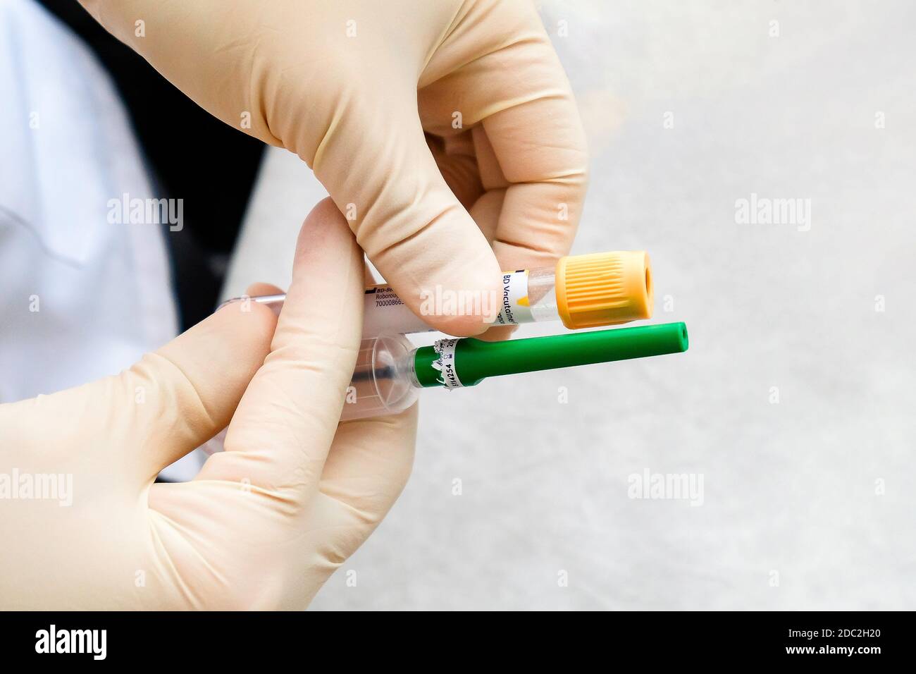 Eine Krankenschwester mit Handschuhen hält ein Vakuumsystem für die Probenentnahme. Stockfoto