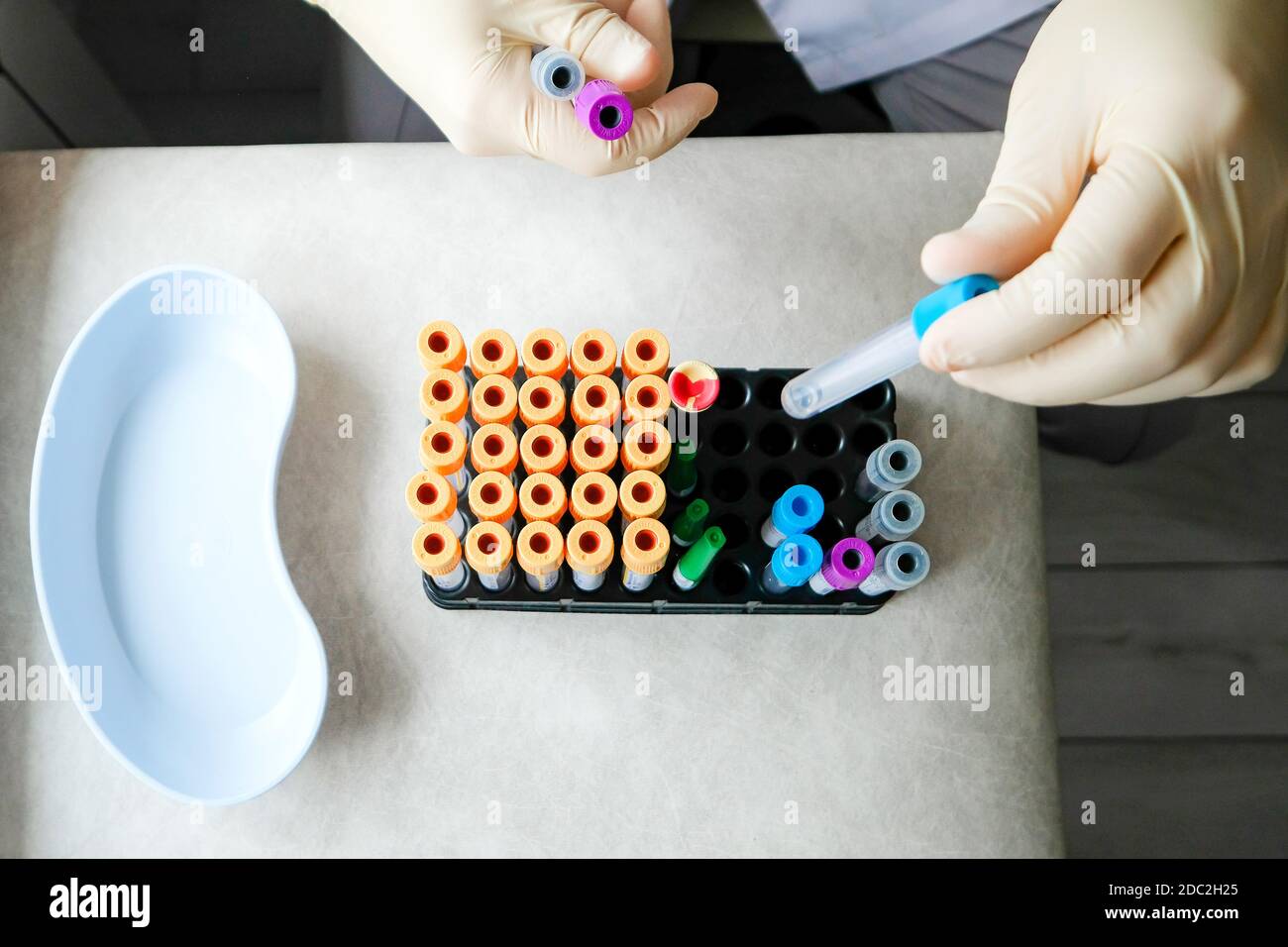 Pflegepersonal arbeitet mit Reagenzgläsern. Draufsicht, Hände in Handschuhen, farbige Schläuche. Stockfoto