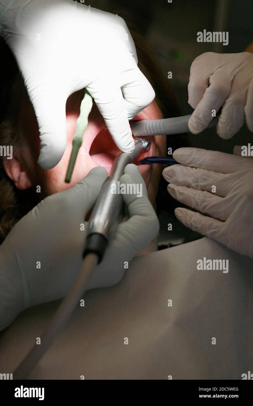 Nahaufnahme Frau erhält Zahnreinigung in Zahnarztpraxis Stockfoto