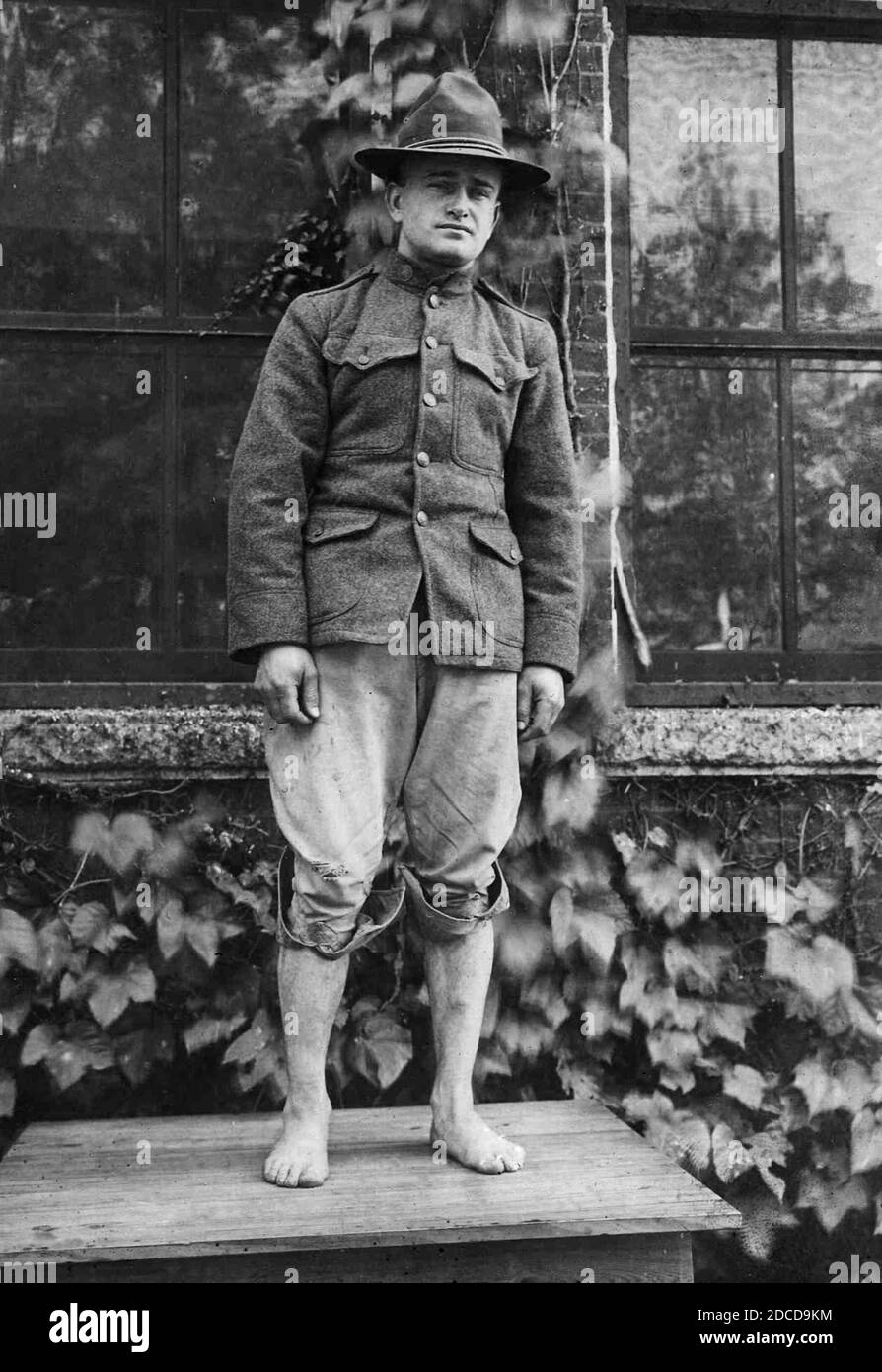 Soldat mit starren flachen Füßen, erster Weltkrieg Stockfoto