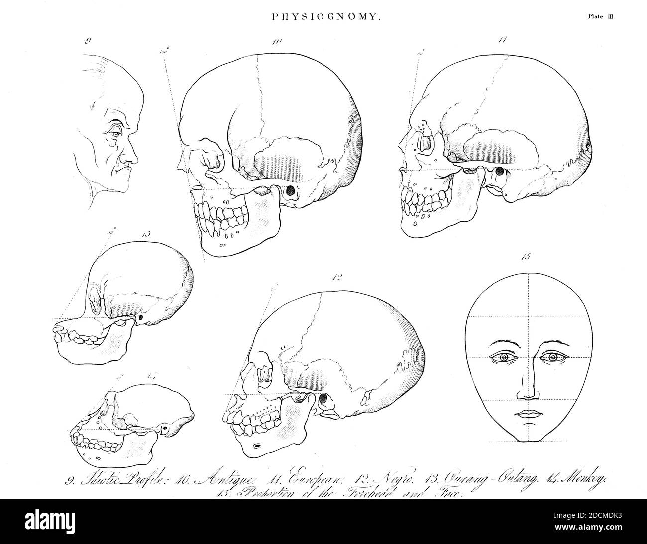 Physiognomie ist die Praxis der Beurteilung einer Person Charakter oder Persönlichkeit aus ihrer äußeren Erscheinung vor allem das Gesicht. Der Begriff kann sich auch auf das allgemeine Erscheinungsbild einer Person, eines Objekts oder eines Geländes beziehen, ohne auf seine impliziten Eigenschaften Bezug zu nehmen. Die Glaubwürdigkeit einer solchen Studie hat sich verändert. Die Praxis wurde von den antiken griechischen Philosophen gut angenommen, fiel aber im Mittelalter in Verruf, wenn sie von Vagabunden und Bergbanken praktiziert wurde. Es wurde dann von Johann Kaspar Lavater wiederbelebt und popularisiert, bevor es im späten 19. Jahrhundert wieder aus der Gunst fiel. Physiognomie wie in der verstanden Stockfoto