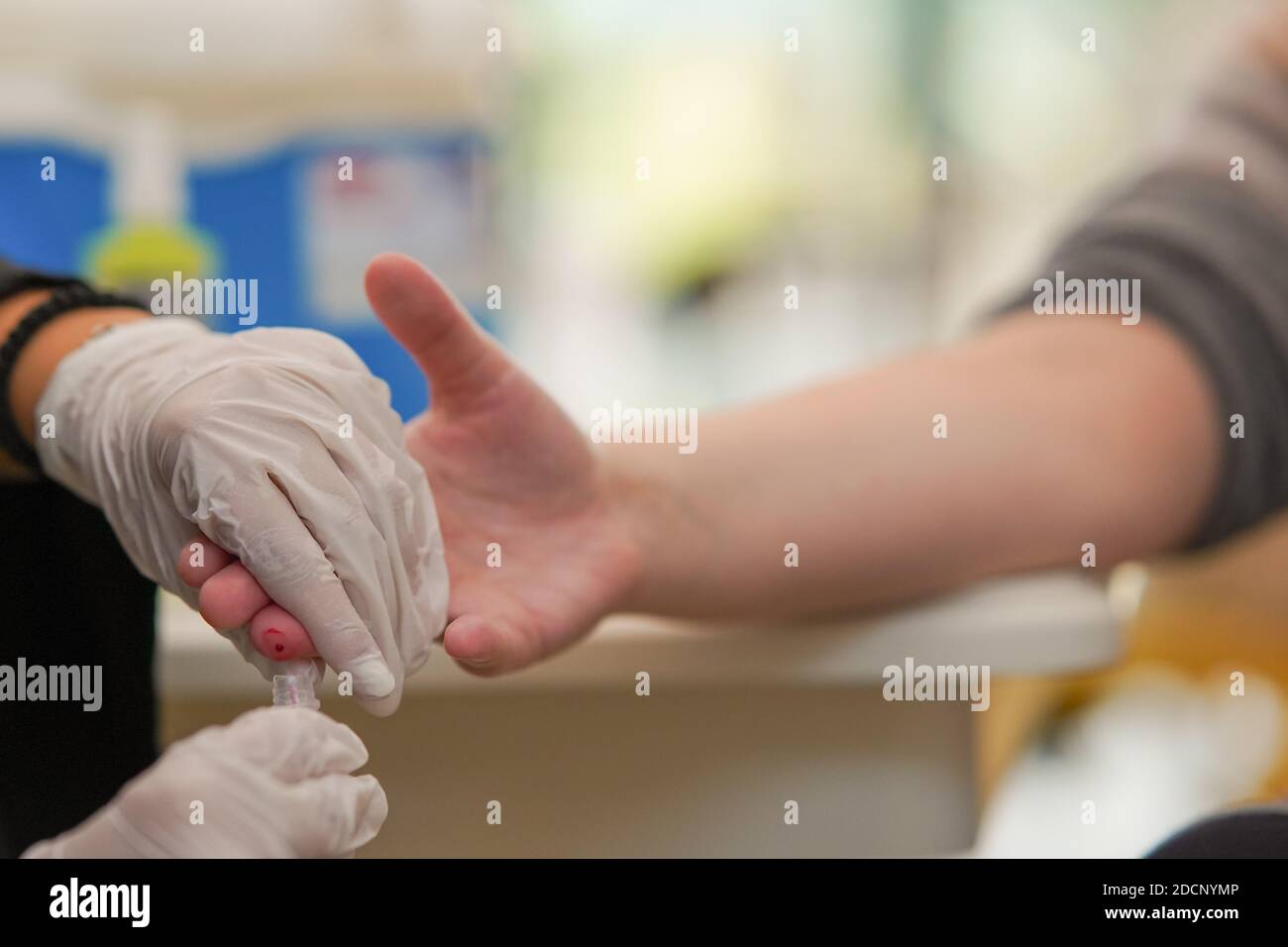 Breiteres Bild einer Krankenschwester, die eine Blutprobe nimmt Von einem Finger eines Patienten in das Fläschchen während Sterile Handschuhe im Labor tragen Stockfoto