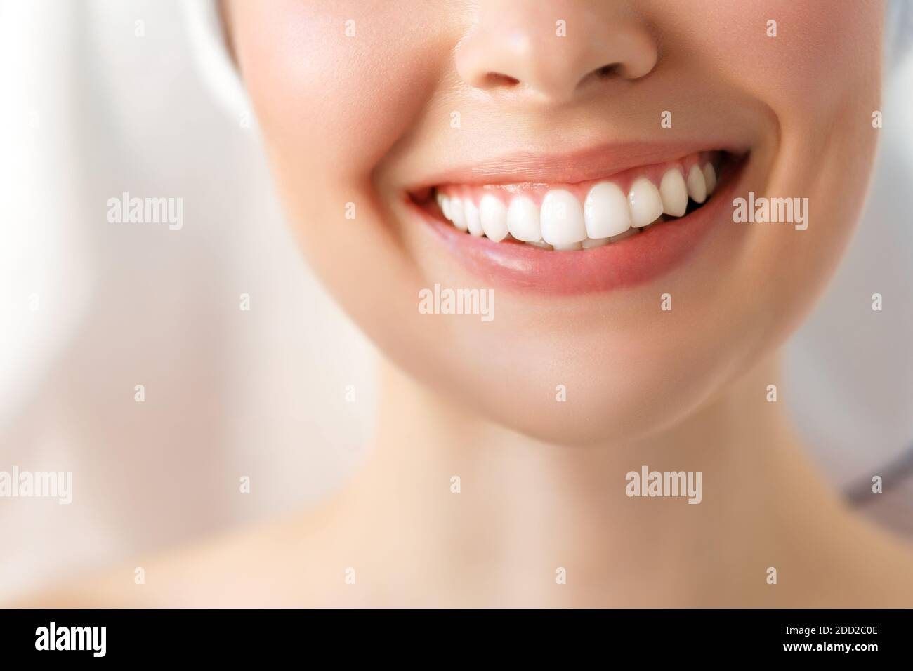 Perfekte gesunde Zähne Lächeln einer jungen Frau. Zahnaufhellung. Bild symbolisiert Zahnheilkunde, Stockfoto