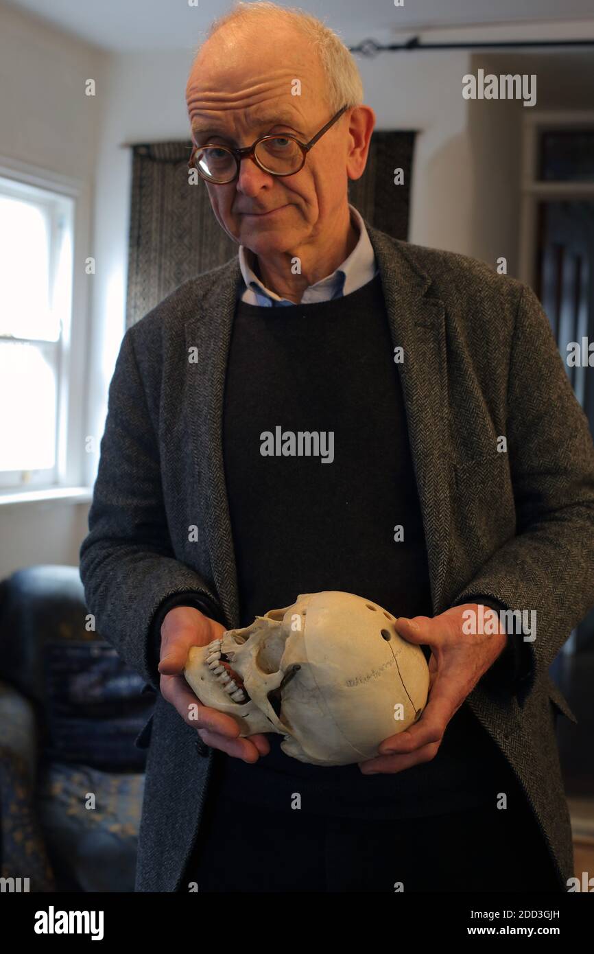 GROSSBRITANNIEN / England /London / Henry Marsh , führender britischer Neurochirurg und Autor des Buches Do No Harm .Holding a human Skull. Stockfoto