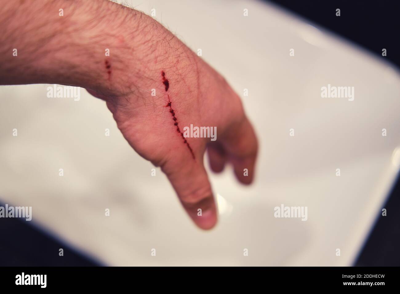 Hand von einer Katze über dem Waschbecken gekratzt, Blut Nahaufnahme  Stockfotografie - Alamy