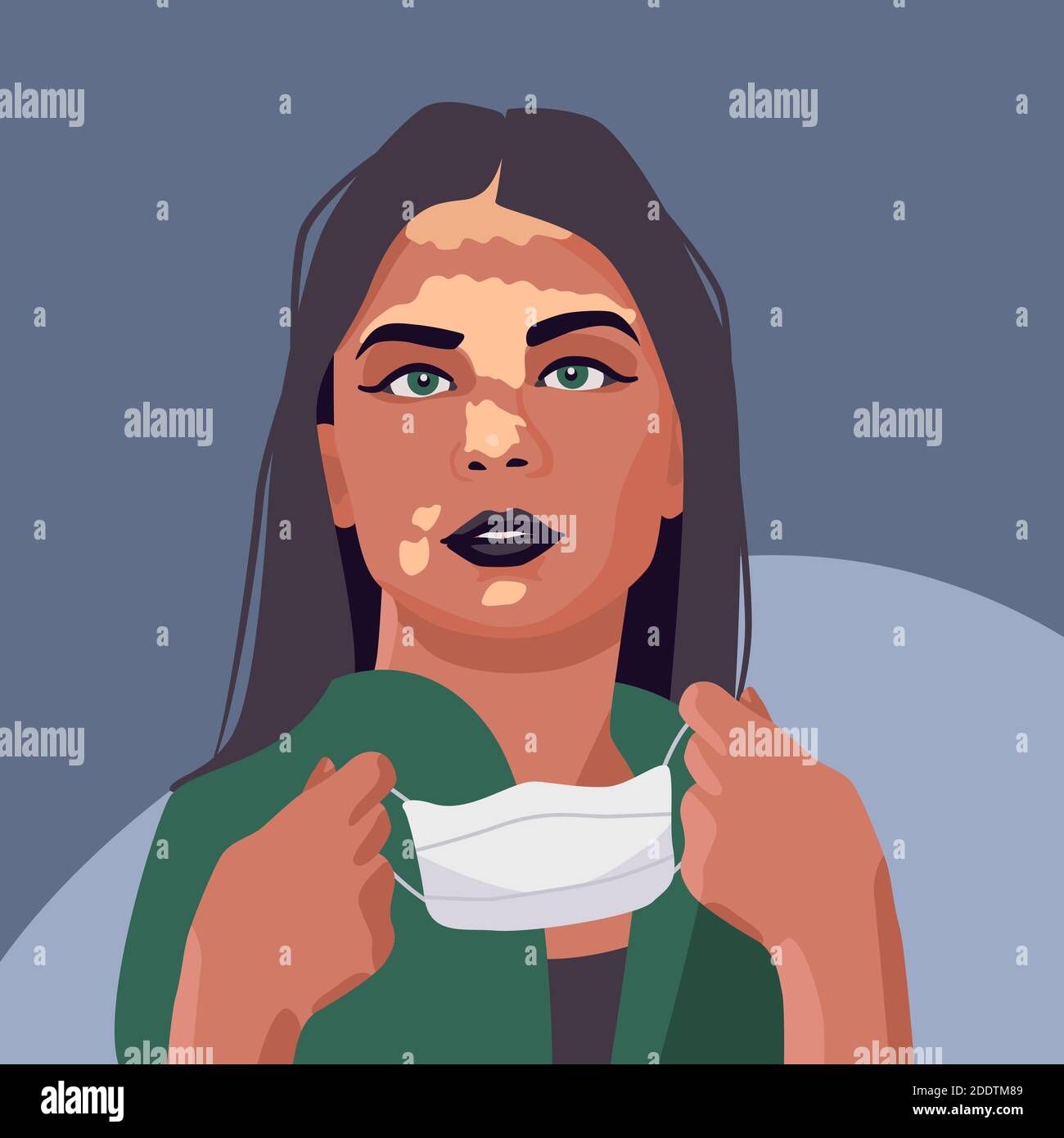 Vitiligo Frau mit Maske auf grauem Hintergrund. Menschen Vielfalt für soziale Banner oder Propaganda, Hygiene-Förderung, medizinische Poster. Logo der Apotheke oder i Stock Vektor