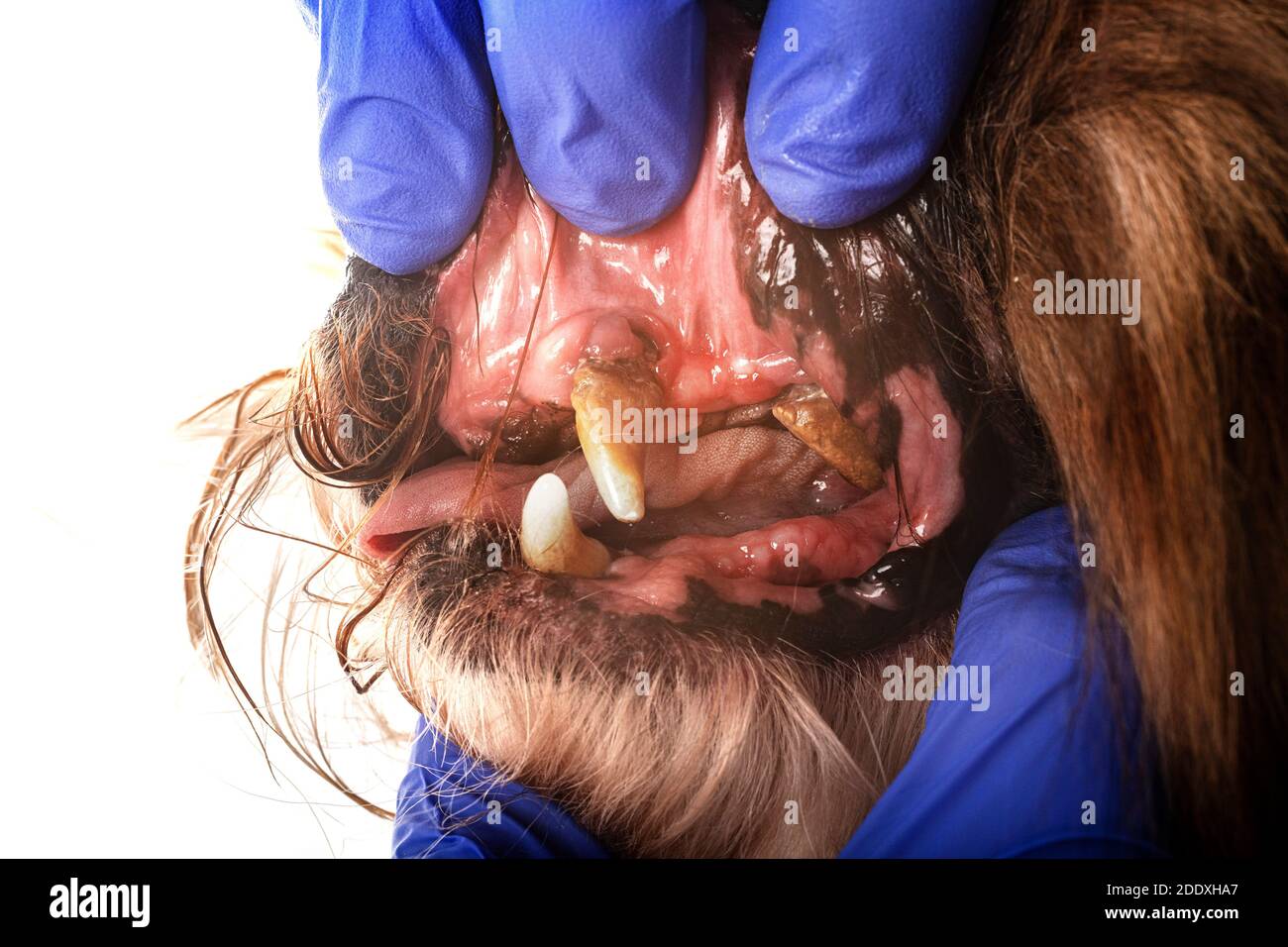 Zahnbelag vor weißem Hintergrund Stockfoto
