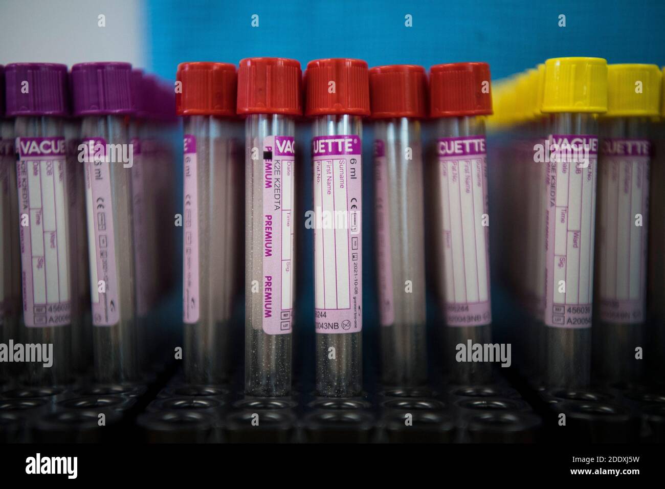 Ein Blick auf Blutfläschchen, mit rot gedeckelten Röhrchen, die zur Überprüfung auf Viren im Blut verwendet werden, im NHS Blood and Transplant Convalescent Plasma Program im Twickenham Plasma Pop-up Center in London. Stockfoto