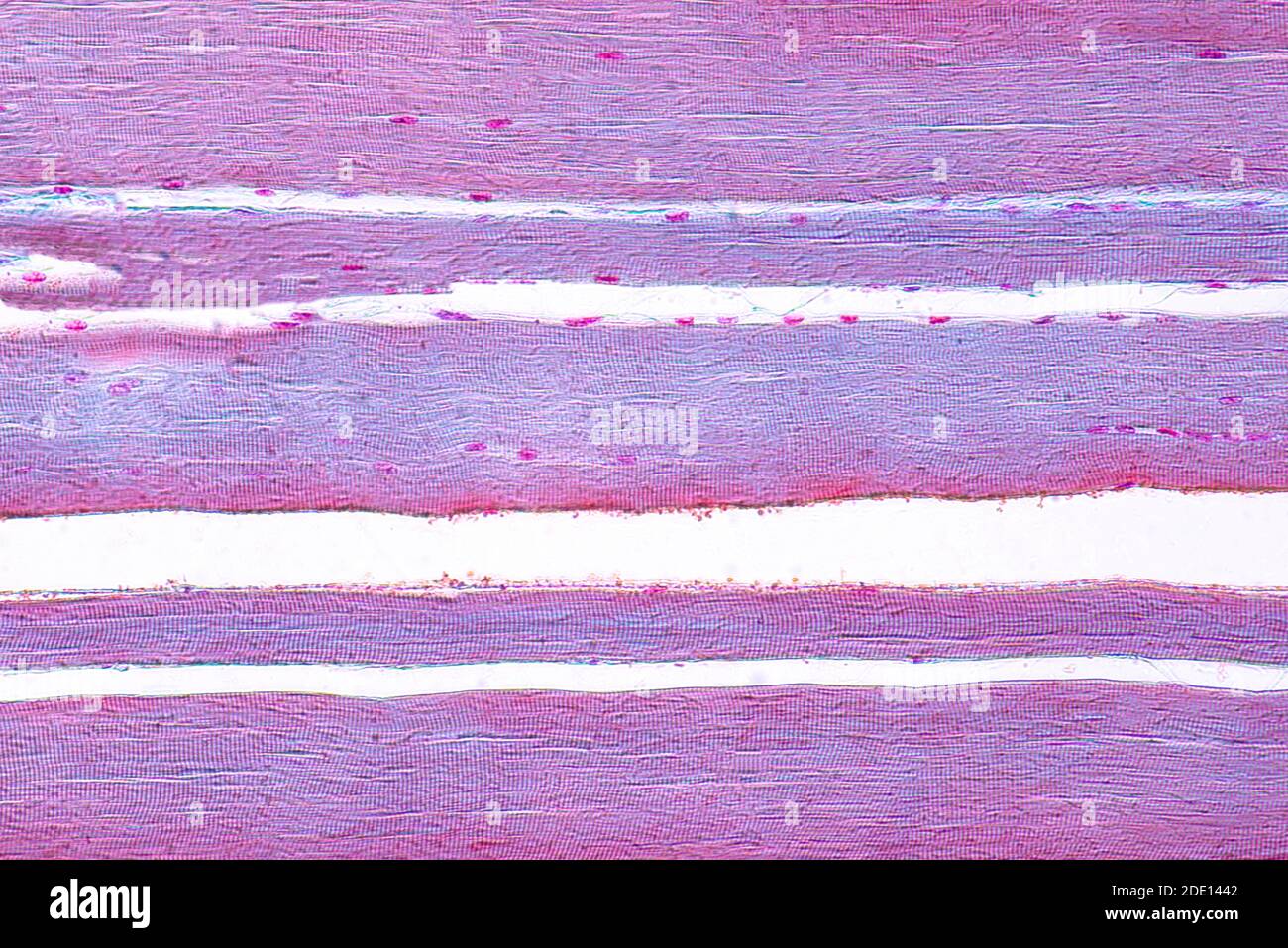 Menschliche Skelettmuskulatur, leichte Mikrograph Stockfoto