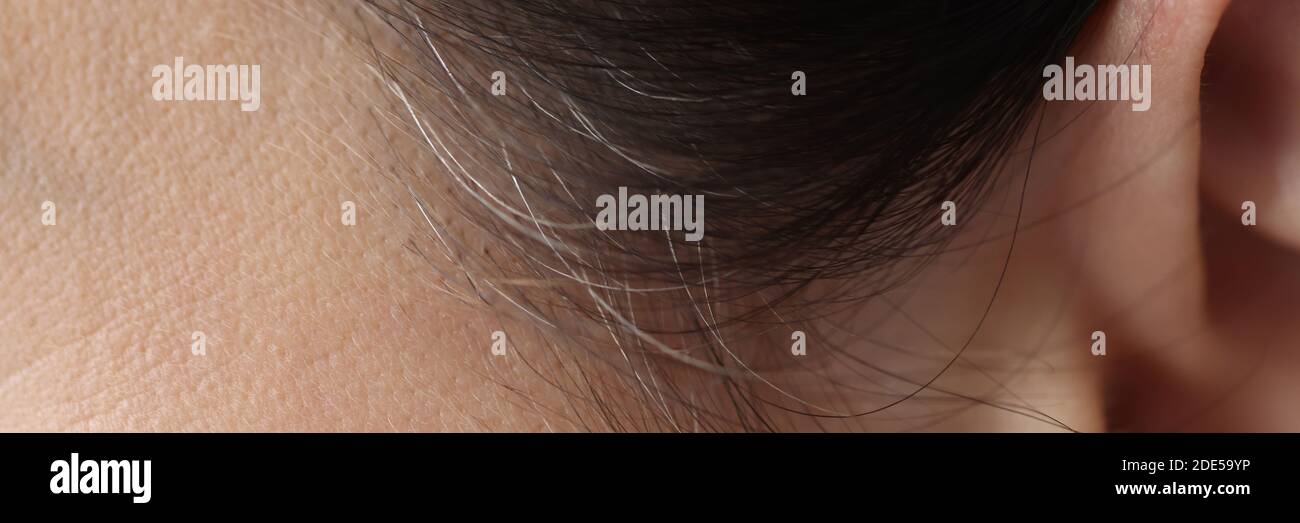 Schwarze und graue Haare auf Schläfen von Kopf Nahaufnahme Stockfoto