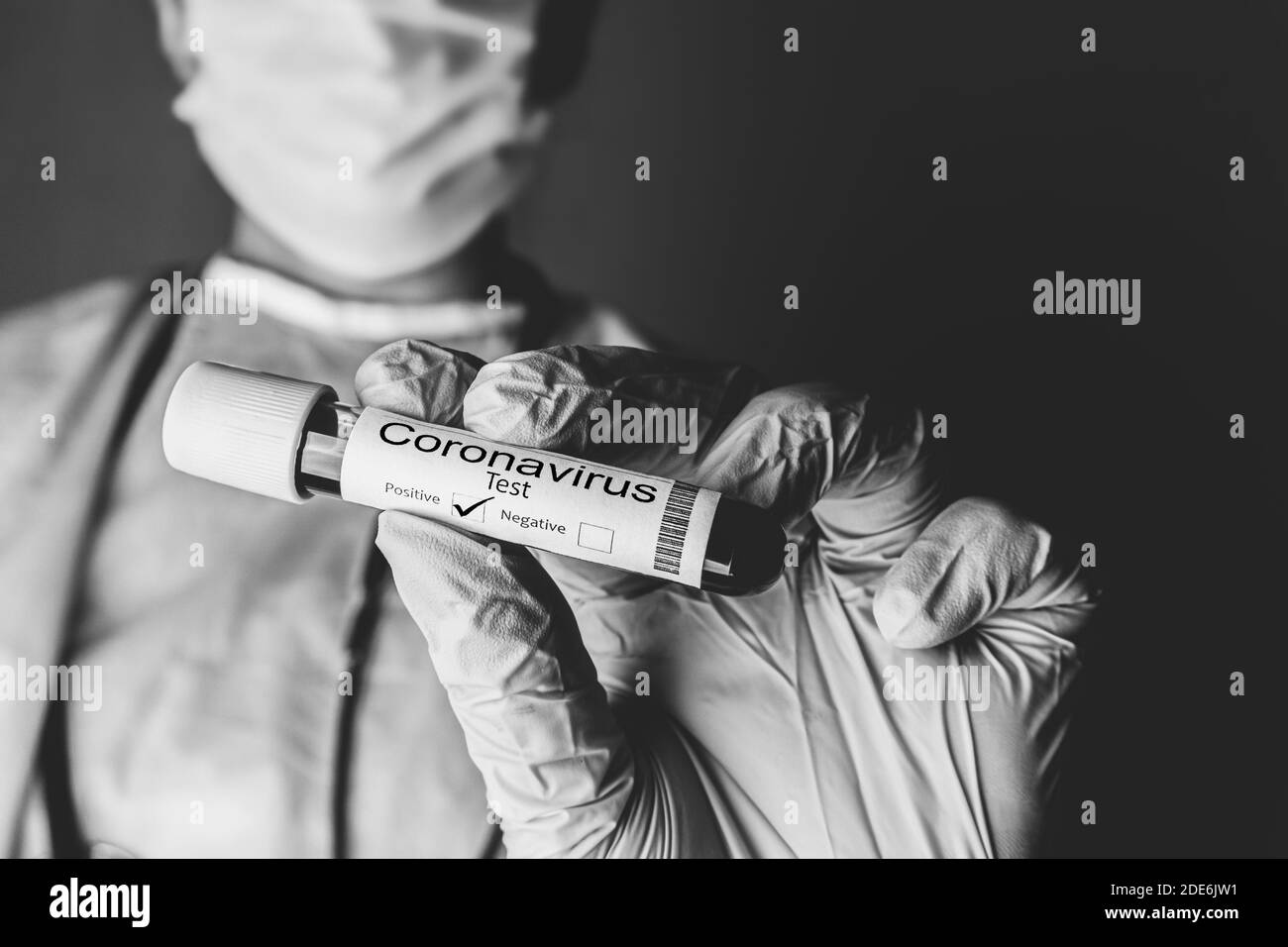Der Arzt hält ein Reagenzglas mit einer Patientenprobe, die positiv auf Coronavirus getestet wurde. Covid-19-Konzept. Stockfoto