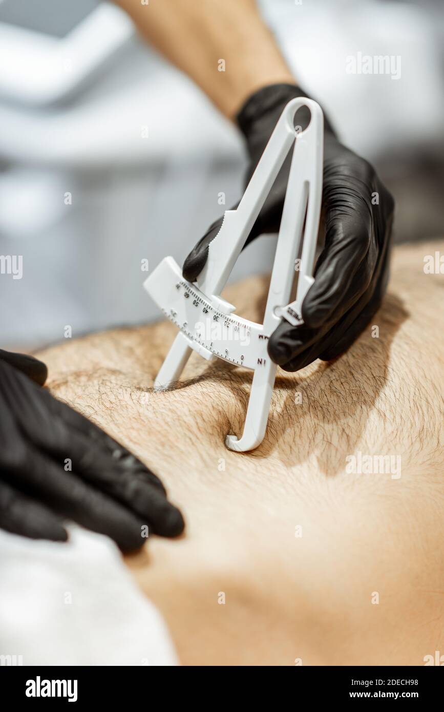 Bestimmung der Menge an Talg auf männlichen Bauch mit medizinischen Caliper, Nahaufnahme Stockfoto