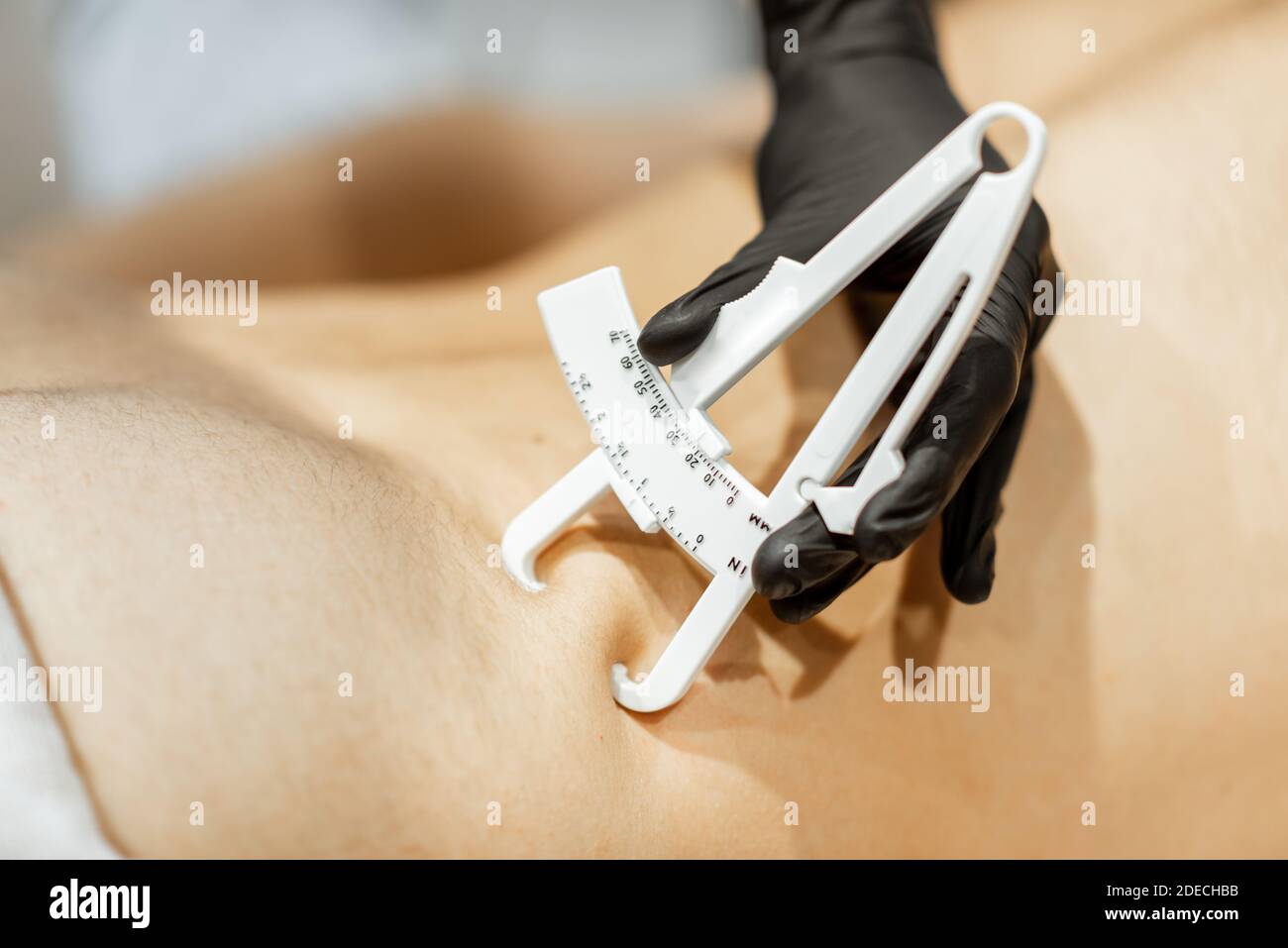 Bestimmung der Menge an Talg auf männlichen Bauch mit medizinischen Caliper, Nahaufnahme Stockfoto