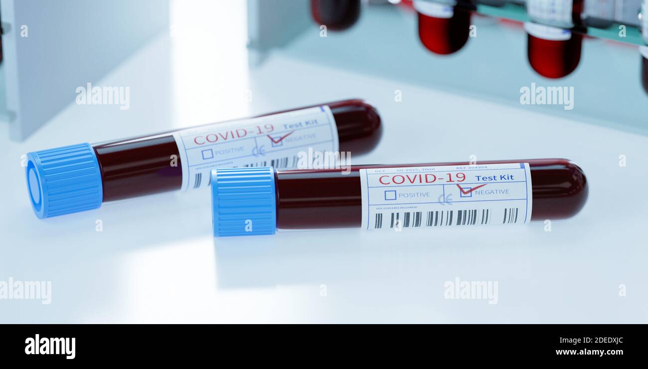 Coronavirus Covid19 Reagenzgläser in einem Rack. Medizinisches Screening und Covid Tests Produktion 3d Rendering Stockfoto
