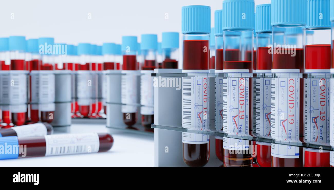 Coronavirus Covid19 Reagenzgläser in einem Rack. Medizinisches Screening und Covid Tests Produktion 3d Rendering Stockfoto