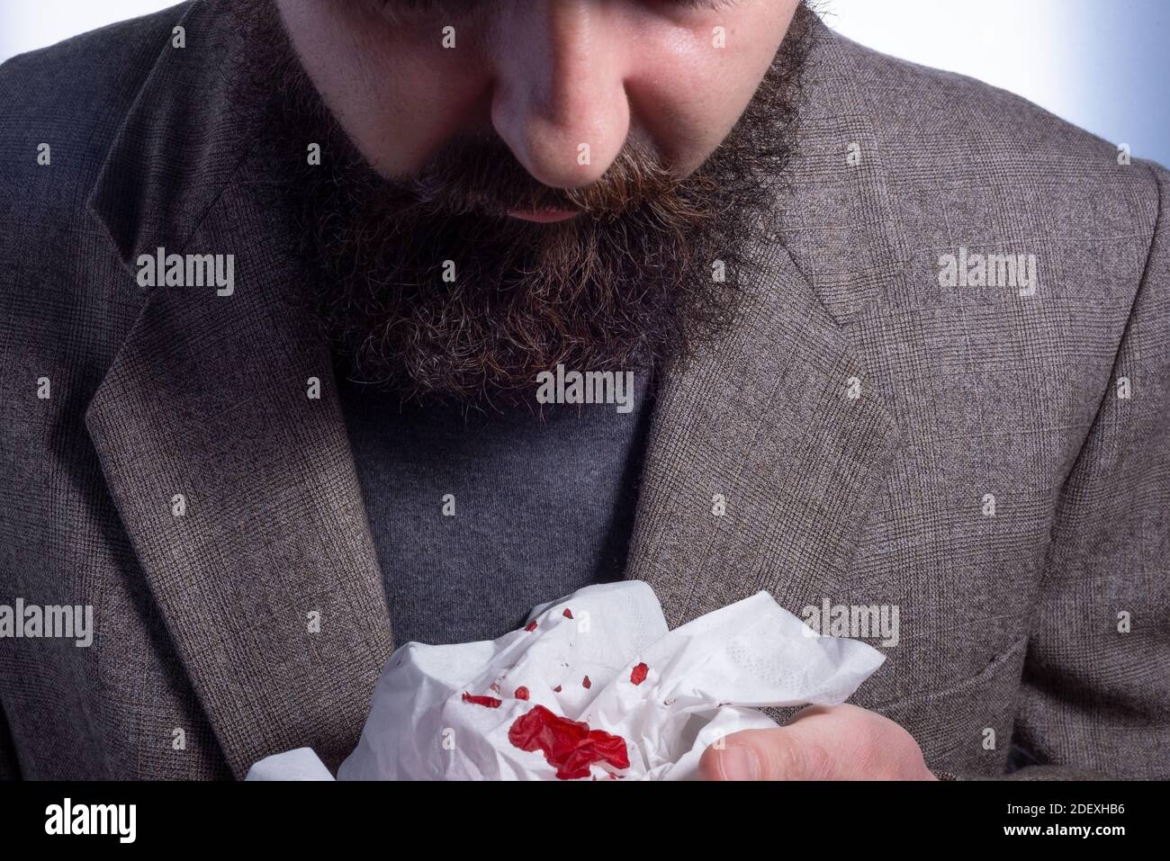 Blutiger Husten, bärtiger Geschäftsmann hustet Blut in eine Serviette, Nahaufnahme, medizinisches Konzept Nahaufnahme von einem Mann mit blutigem Gewebe Stockfoto
