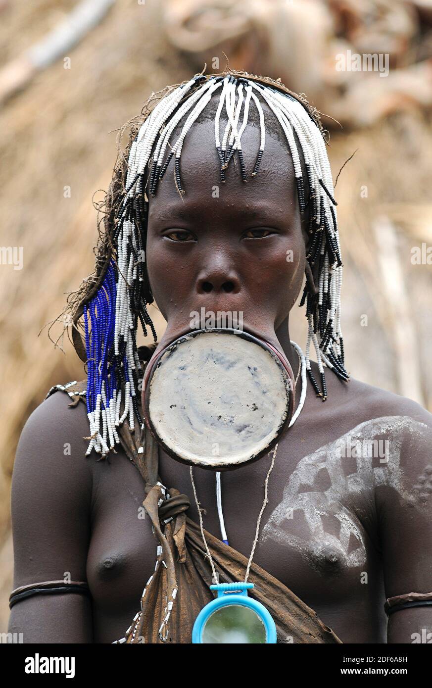 Mursi Mädchen mit Lippenteller. Mursi oder Mun Menschen sind animist und pastoralistisch und wohnen im südlichen Äthiopien an der Südsudan Grenze. Lippenteller sind Stockfoto