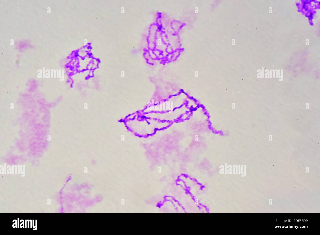 Riesige oder polytene Chromosomen der Chironomus Speicheldrüsen. Optisches  Mikroskop X400 Stockfotografie - Alamy