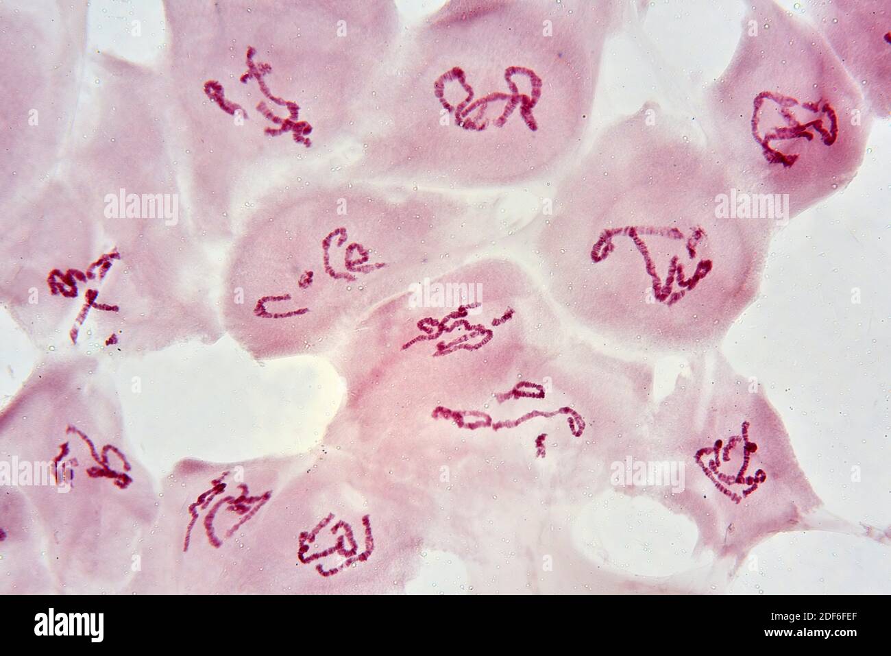 Riesige oder polytene Chromosomen der Chironomus Speicheldrüsen. Optisches  Mikroskop X100 Stockfotografie - Alamy