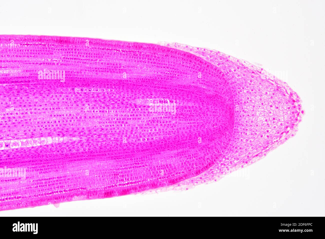 Calyptra oder Wurzelkappe, die Statozyten zeigt, die für die Schwerkraftwahrnehmung in den Pflanzen verantwortlich sind. Optisches Mikroskop X100. Stockfoto