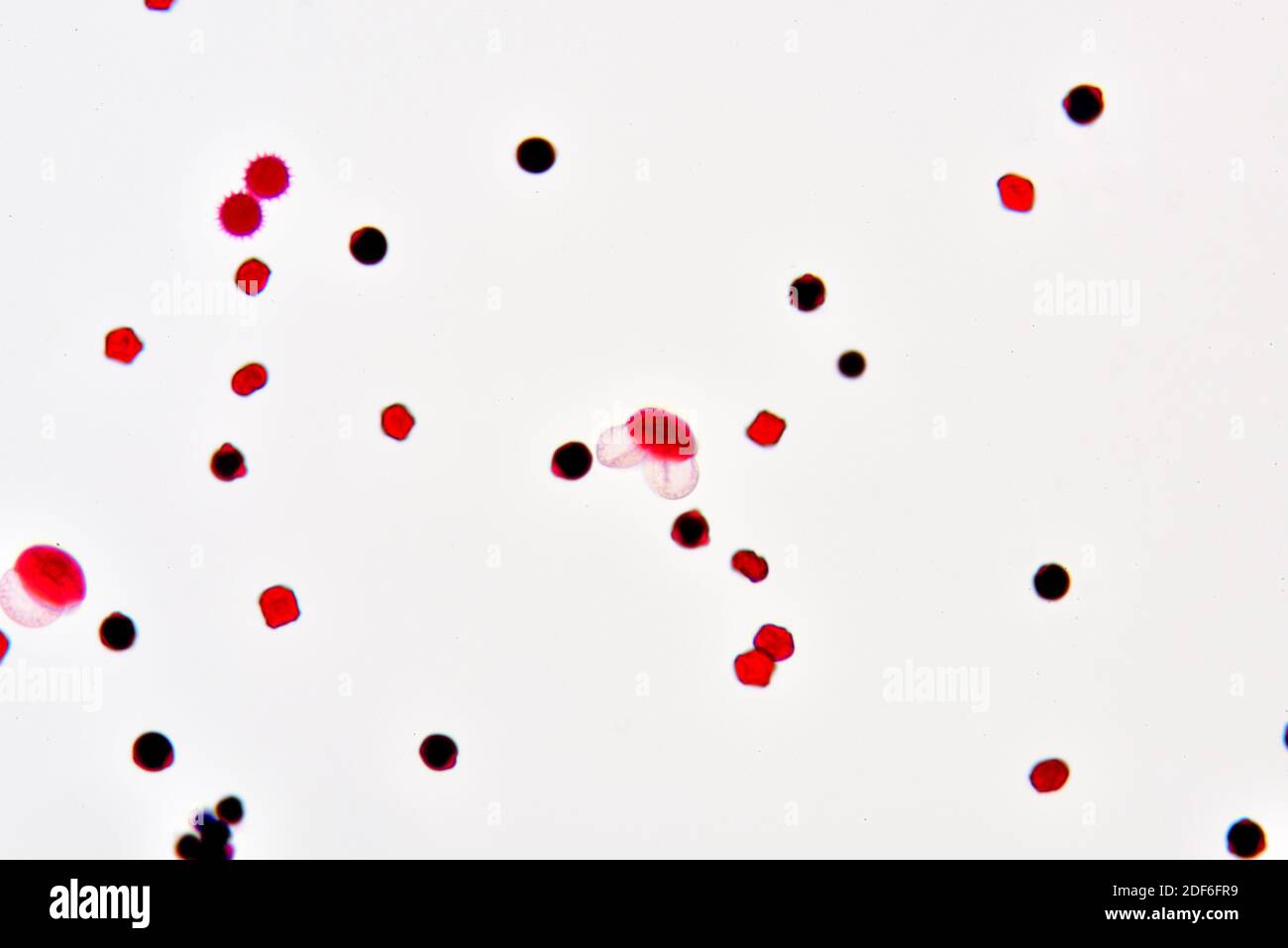 Pollen von verschiedenen Arten. Optisches Mikroskop X200. Stockfoto