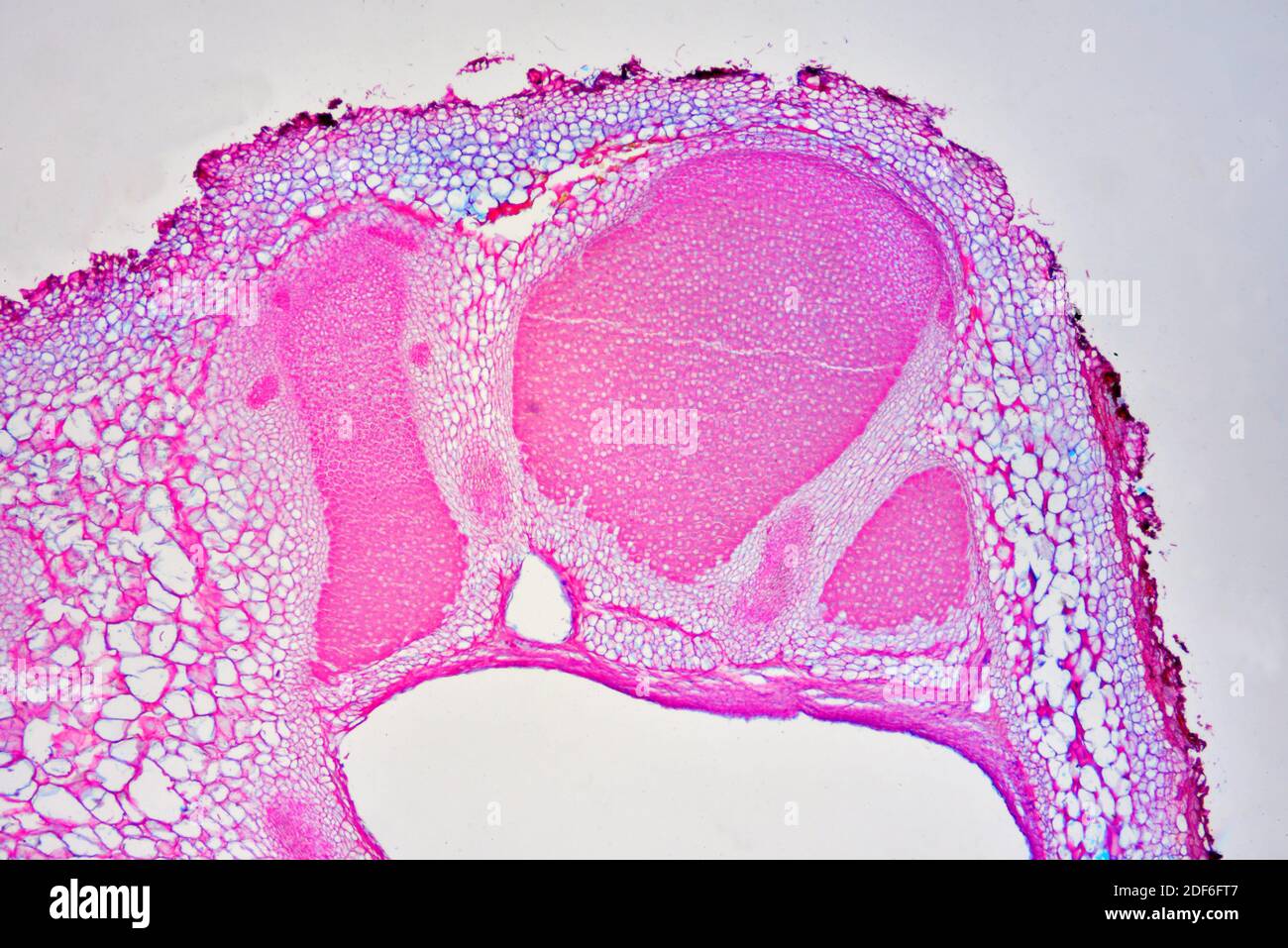 Lupinuswurzel (Querschnitt) mit Rhizobium radicicola, fixieren Stickstoffbakterien. Optisches Mikroskop X40. Stockfoto