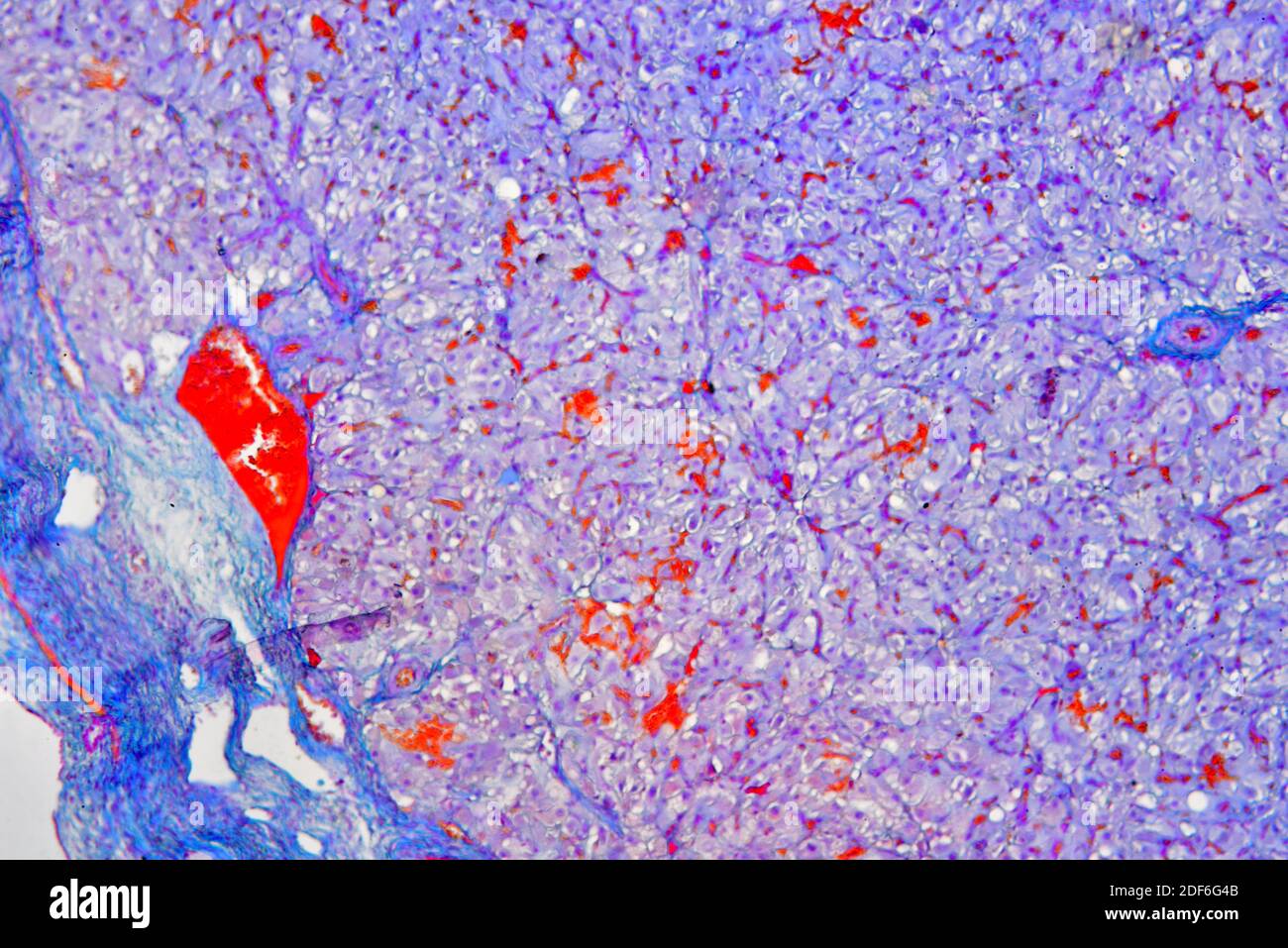 Ovary Section Stockfotos Und Bilder Kaufen Alamy