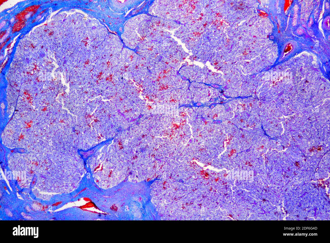 Ovary Section Stockfotos Und Bilder Kaufen Alamy