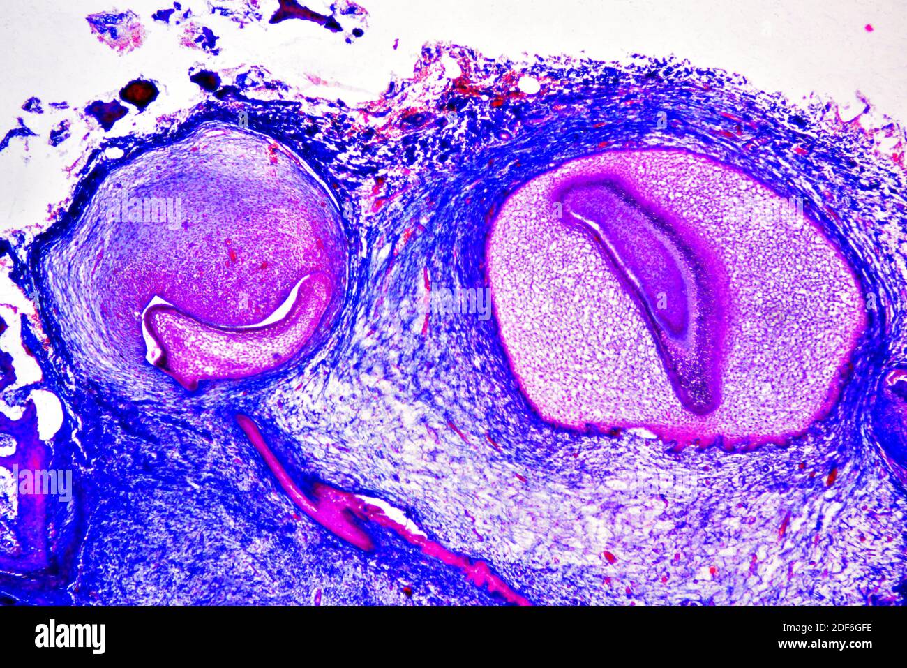Bindegewebe in einem Zahn in Bildung. Optisches Mikroskop X40. Stockfoto