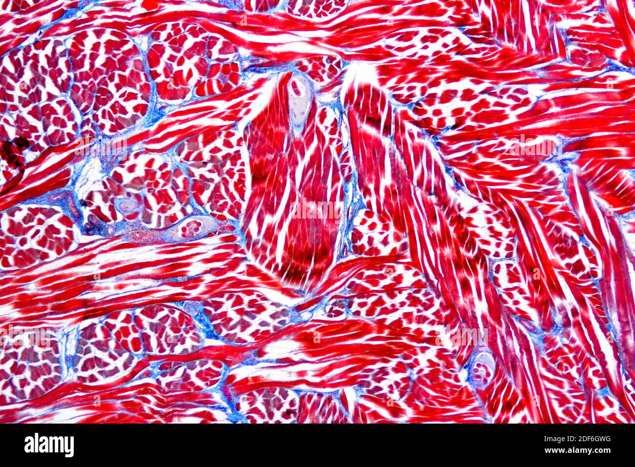 Wurmlarven (Trichinella spiralis) in einem Muskelgewebe. Optisches Mikroskop X40. Stockfoto