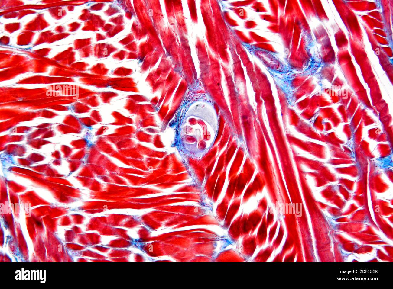 Wurmlarven (Trichinella spiralis) in einem Muskelgewebe. Optisches Mikroskop X100. Stockfoto