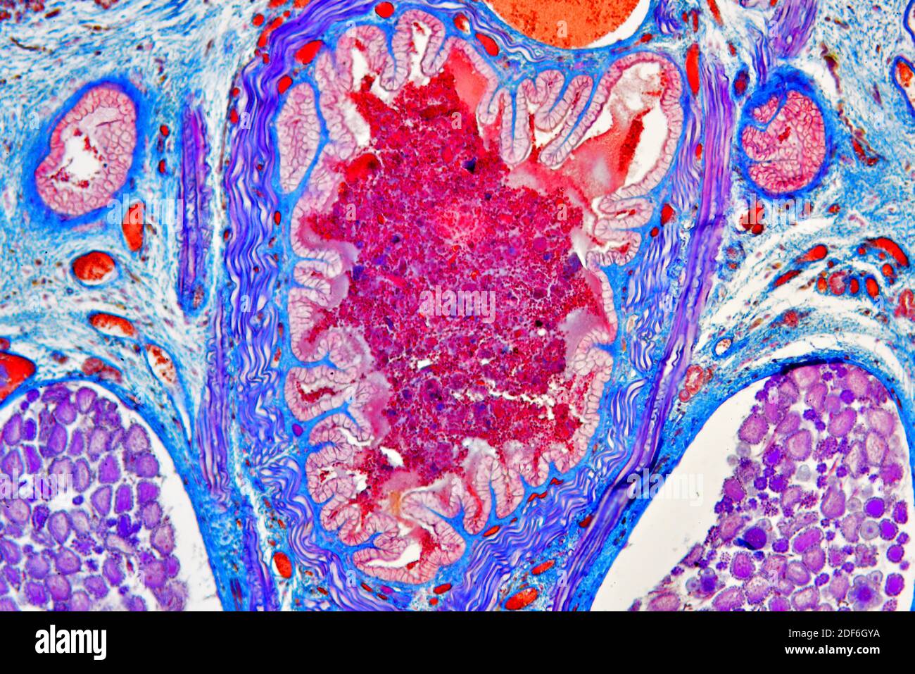 Europäischer medizinischer Lauchquerschnitt (Hirudo medicinalis), der Gebärmutter, Darm und Fruchtdiverticulum zeigt. Optisches Mikroskop X100. Stockfoto