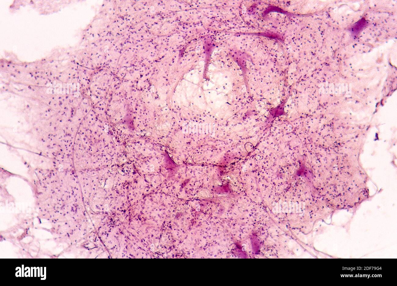 Axone von motorischen Neuronen. Photomikrograph. Stockfoto