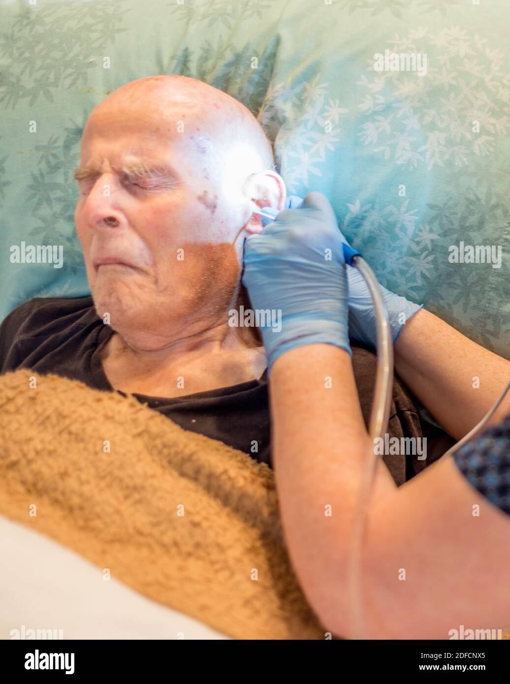 Bettlägiger älterer Mann, der sich lange einer unangenehmen, aber notwendigen Behandlung unterziehen muss Begriff Aufbau von Ohrenschmalz, verdichtet über die Ohrtrommel und Im Ohr Stockfoto