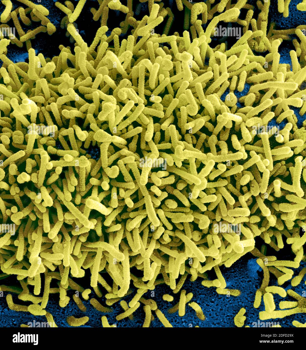 Eingefärbte Rasterelektronenmikroskopie von Marburg-Viruspartikeln (gelb), die sowohl ankeimend als auch an der Oberfläche infizierter VERO-E6-Zellen (blau) befestigt sind. Stockfoto