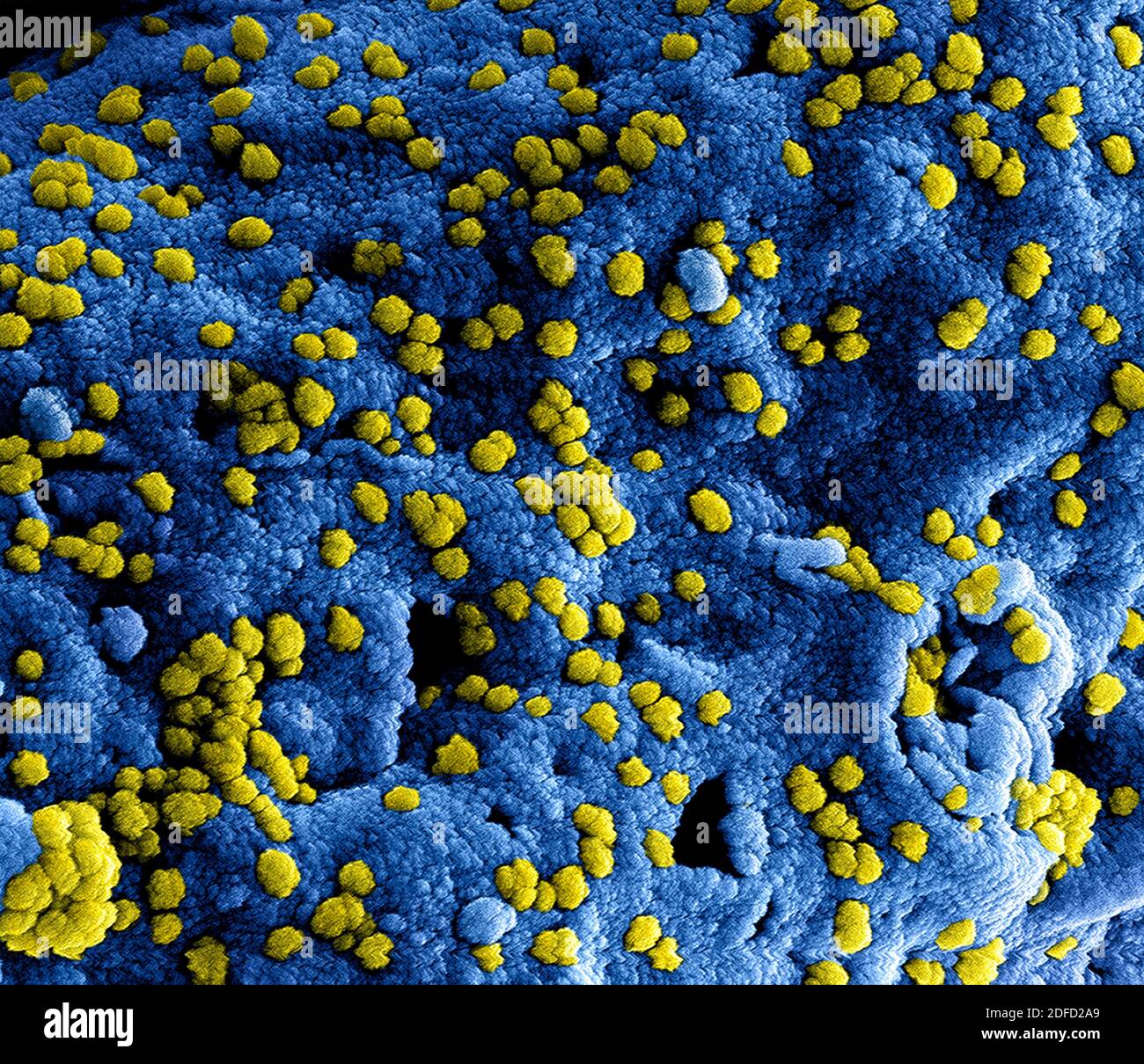Koloriertes Rasterelektronenmikrograph von Viruspartikeln des Middle East Respiratory Syndrome, die an der Oberfläche einer infizierten VERO E6-Zelle befestigt sind. Bild Stockfoto