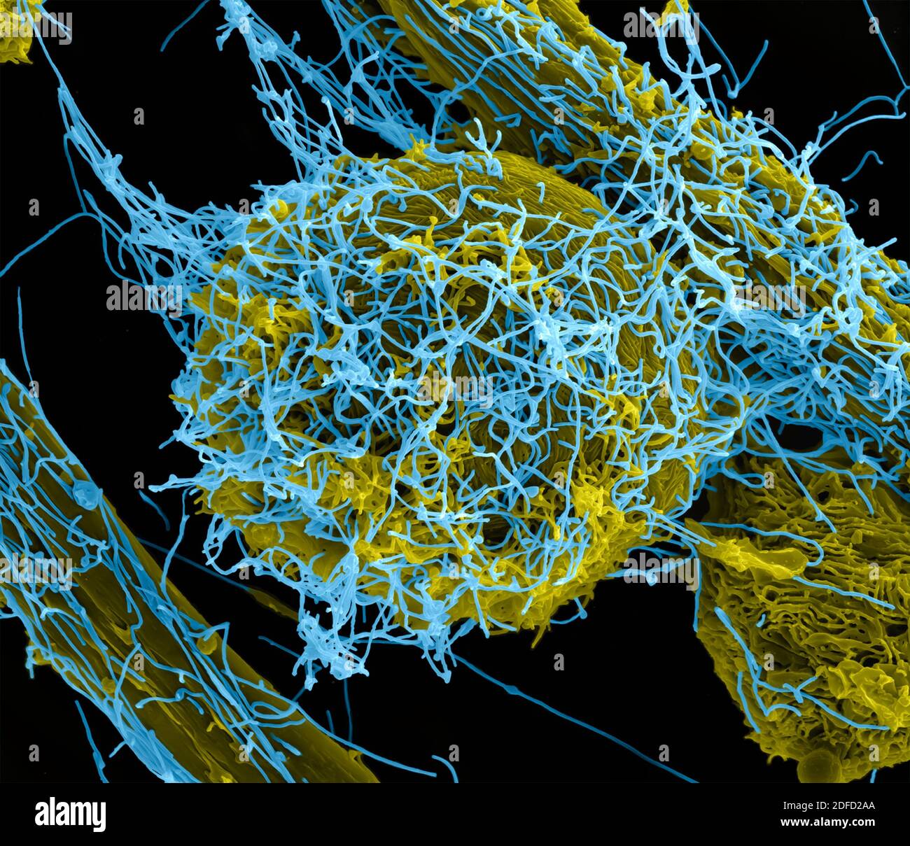 Eingefärbte Rasterelektronenmikroskopie von Ebola-Viruspartikeln (blau), die an der Oberfläche einer infizierten VERO-E6-Zelle (gelb) aufkeimend und befestigt sind. Stockfoto