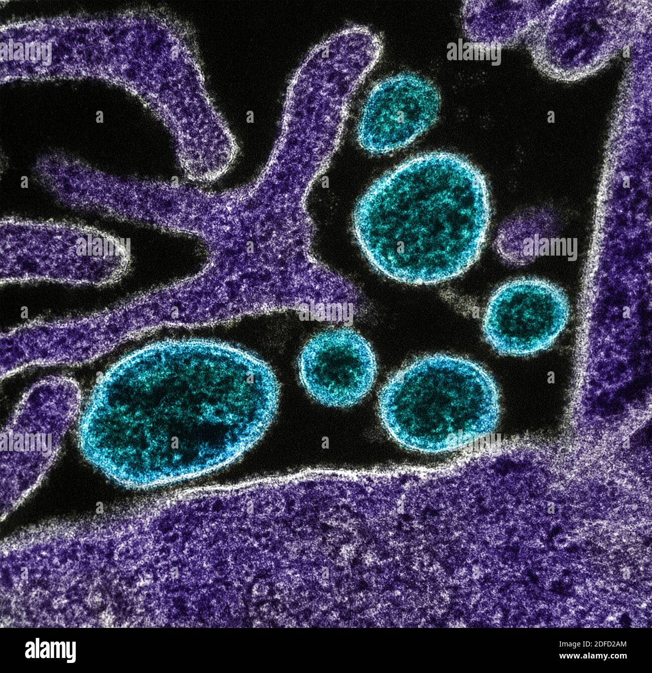 Kolorierte Transmissionselektronenmikrographie von reifen extrazellulären Nipah-Virus-Partikeln (blau) nahe der Peripherie einer infizierten VERO-Zelle (violett). Stockfoto