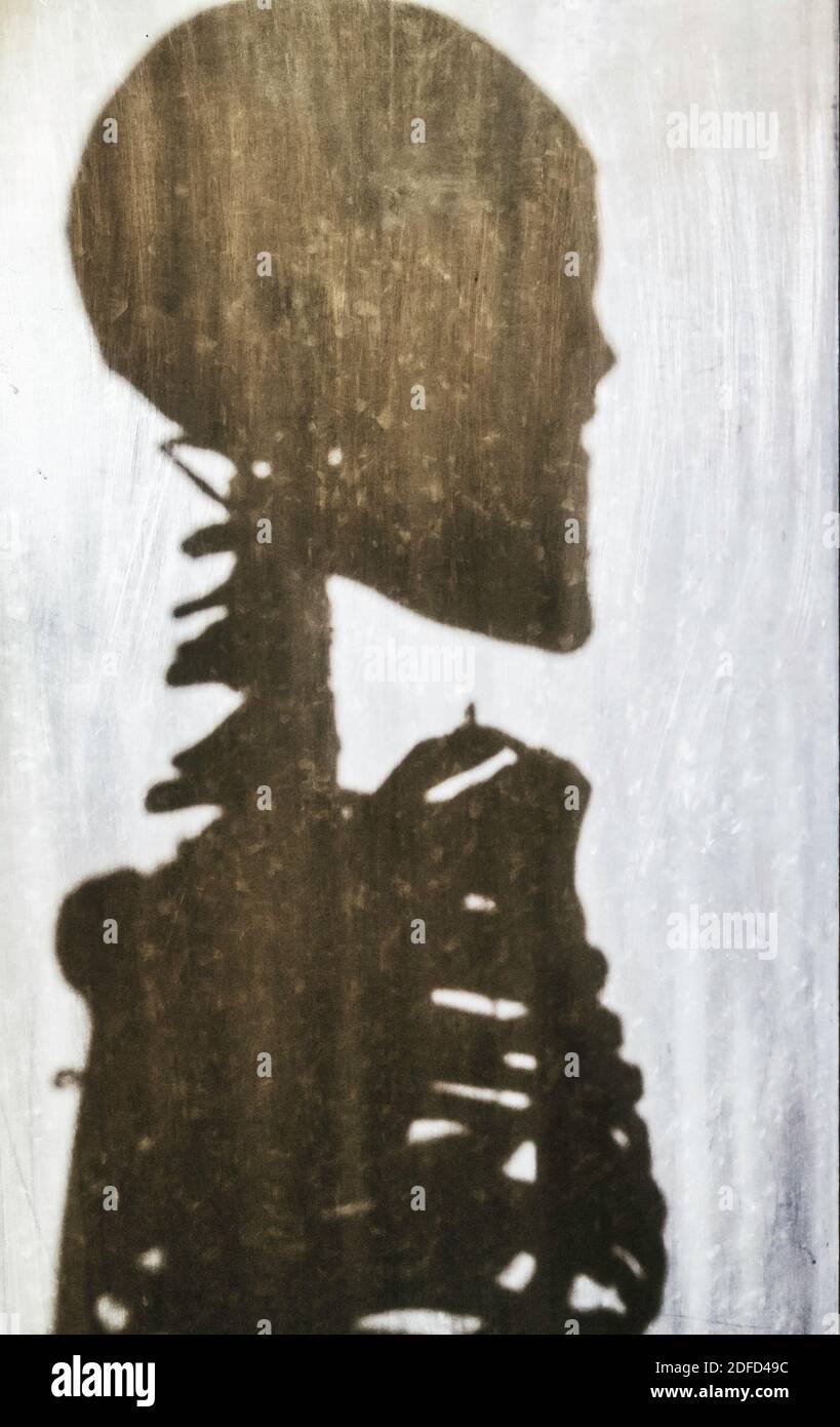 Schatten eines menschlichen Skeletts Stockfoto