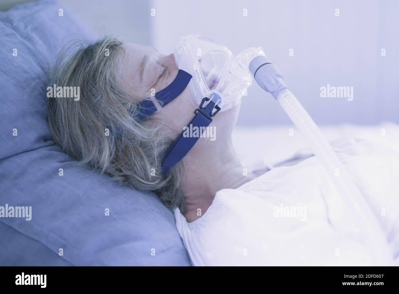 Behandlung von Schlafapnoe und Schnarchen : Patienten mit obstruktiver Schlafapnoe-Syndrom (OSAS) verbunden mit einem kontinuierlichen positiven Atemwegspressu Stockfoto