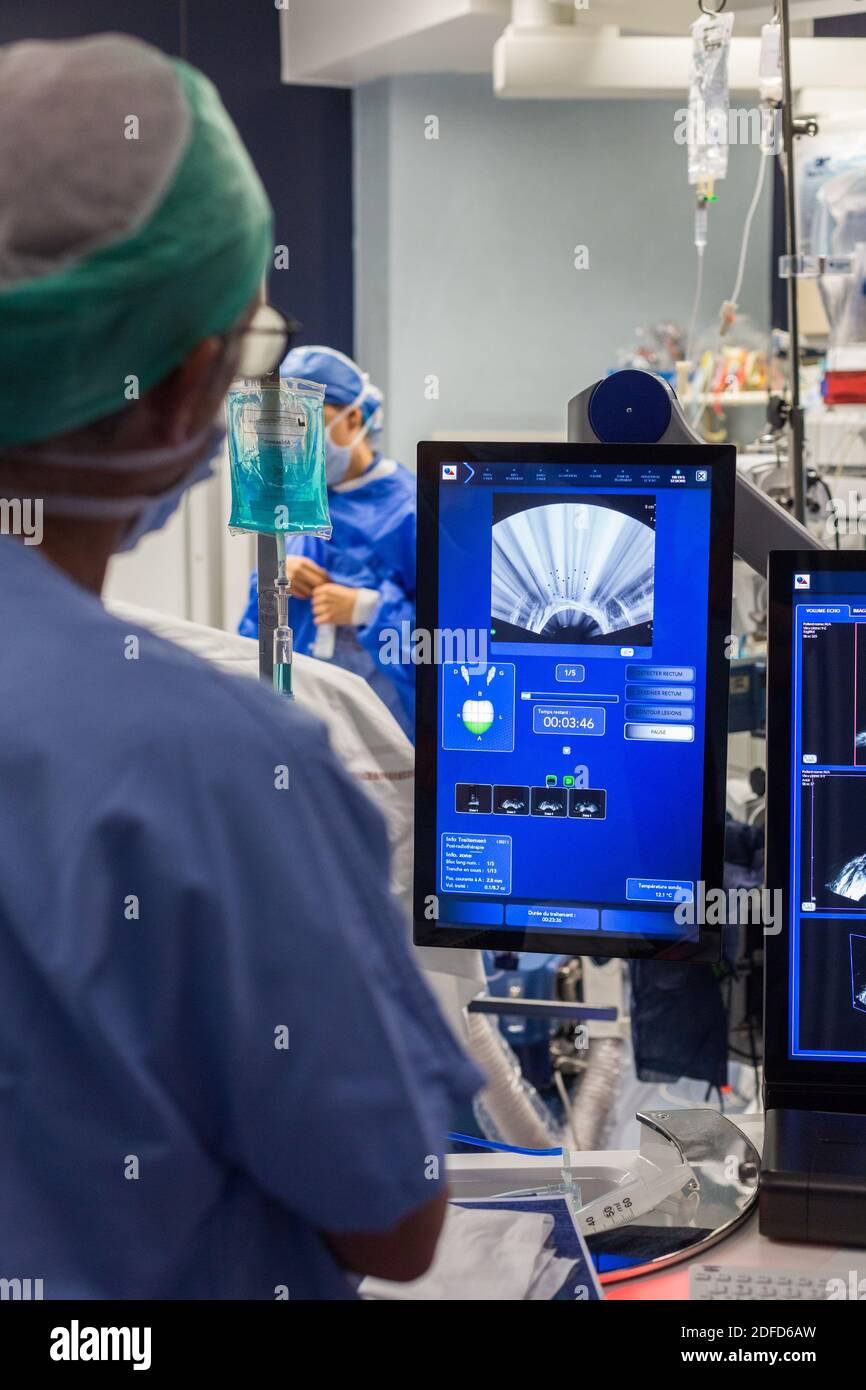 Behandlung von Prostatakrebs durch hochintensiven Fokus-Ultraschall (Focal-One), Bordeaux Krankenhaus, Frankreich. Stockfoto