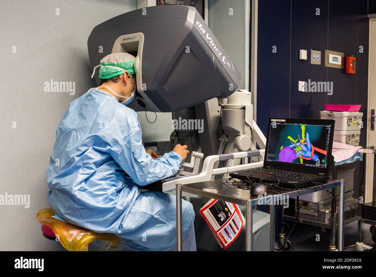 Bildgeführte robotische konservative Nierenchirurgie unterstützt durch 3D-Modellierung, Diese 3D-Modellierung der Niere mit seinem Tumor in lila befindet, führt die s Stockfoto