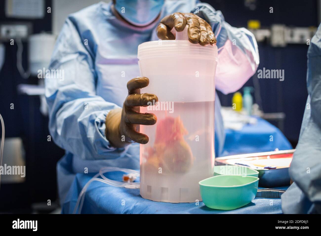 Nierenentfernung durch Laparoskopie von einem lebenden verwandten Spender, der Chirurg ruft und bereitet die Niere in einer kalten Lösung gespeichert, während die warten Stockfoto